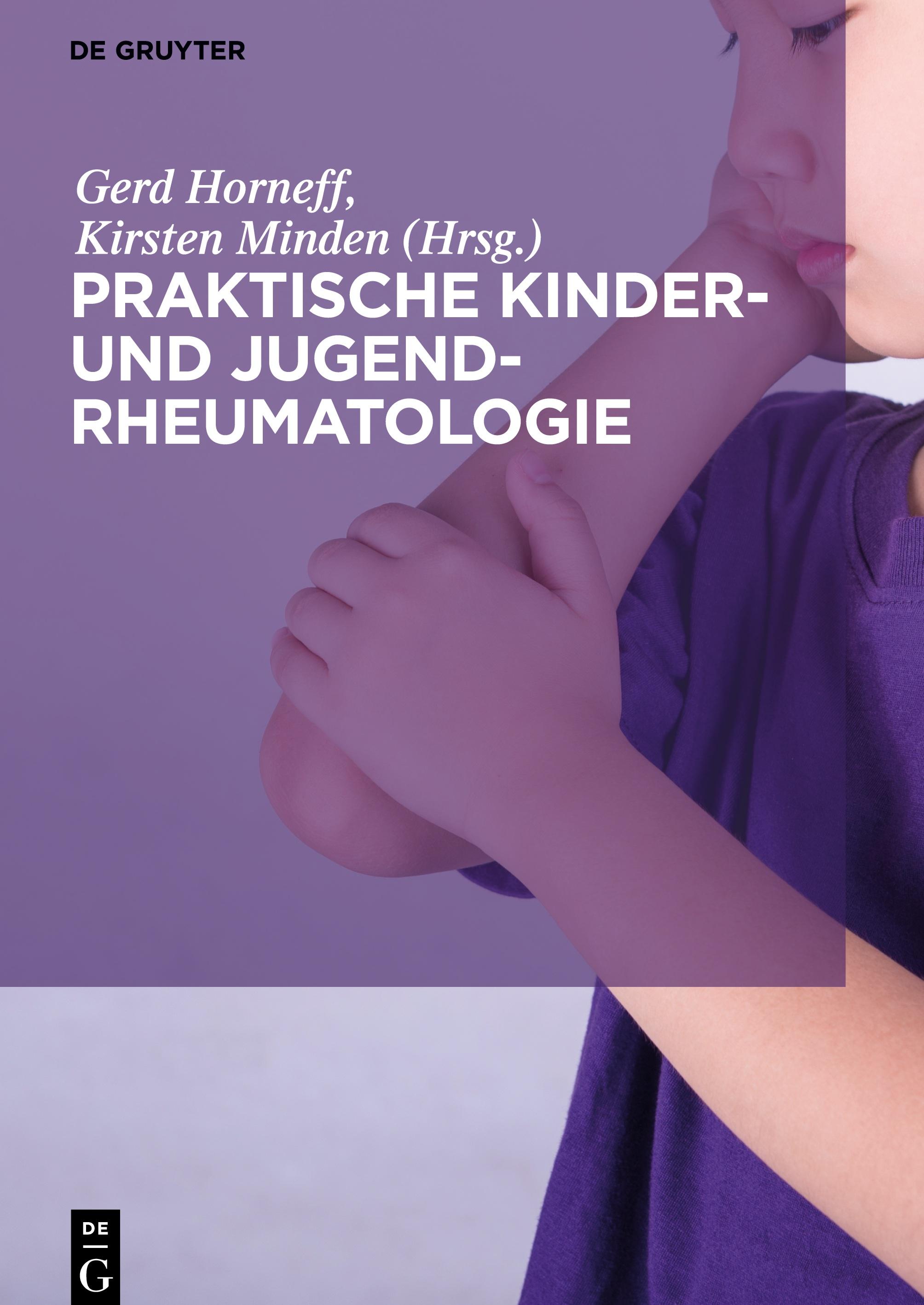 Praktische Kinder- und Jugendrheumatologie