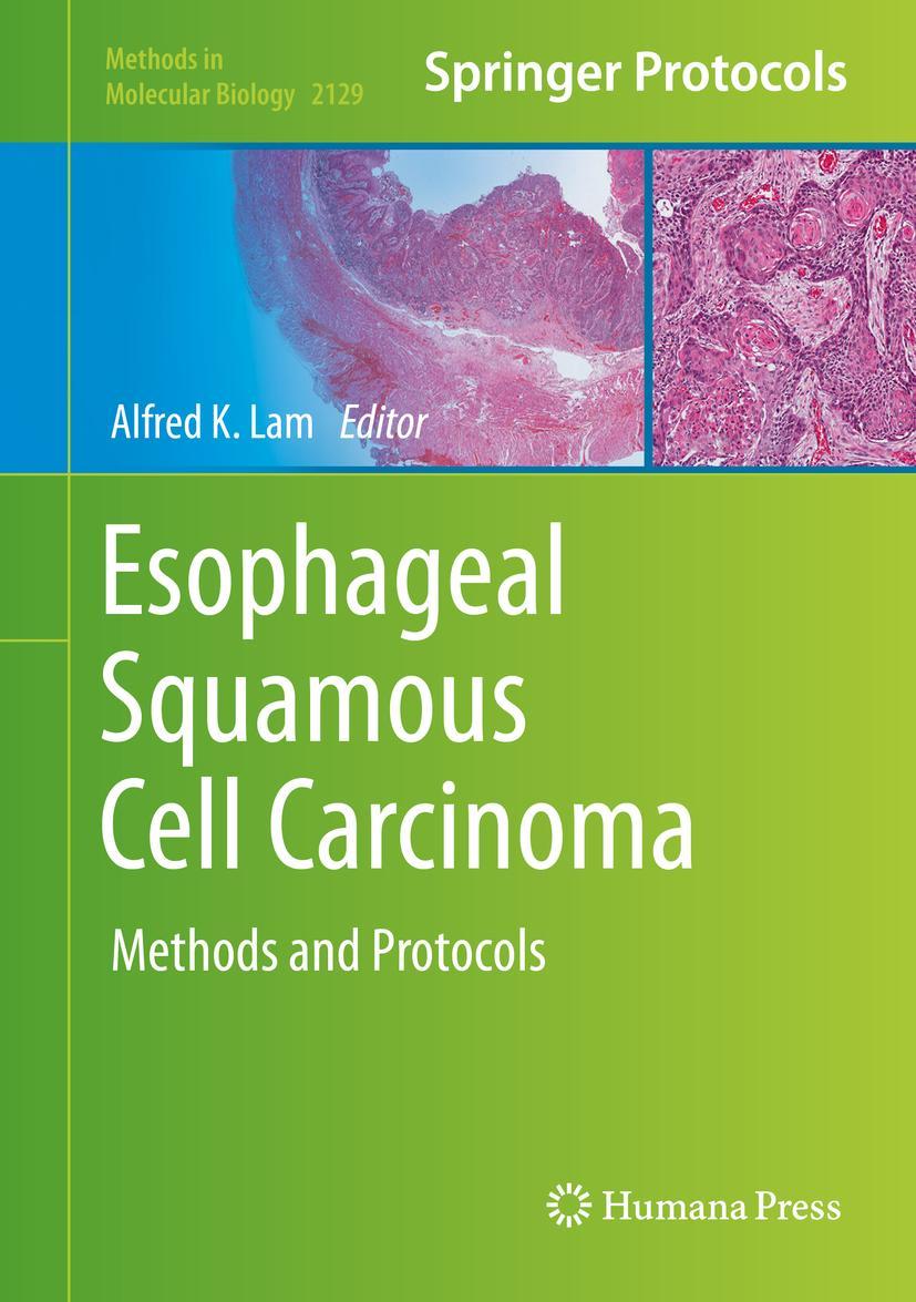 Esophageal Squamous Cell Carcinoma