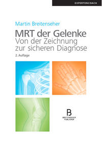 MRT der Gelenke