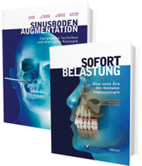 Sinusbodenaugmentation und Sofortbelastung