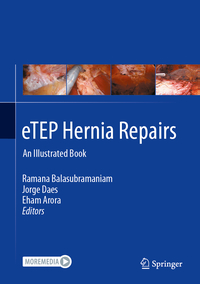 eTEP Hernia Repairs
