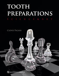 Tooth Preparations