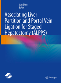 Associating Liver Partition and Portal Vein Ligation for Staged Hepatectomy (ALPPS)