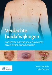 Verdachte huidafwijkingen