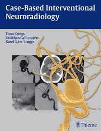 Vorderes Coverbild Case-Based Interventional Neuroradiology