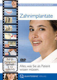 Vorderes Coverbild Zahnimplantate