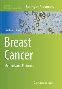 Breast Cancer