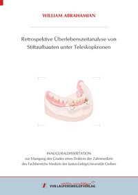 Retrospektive Überlebenszeitanalyse von Stiftaufbauten unter Teleskopkronen