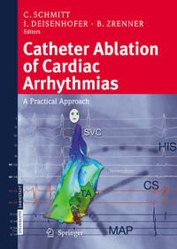 Catheter Ablation of Cardiac Arrhythmias