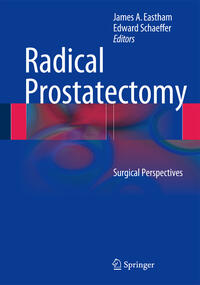 Radical Prostatectomy