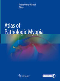 Atlas of Pathologic Myopia
