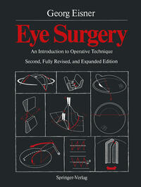 Eye Surgery