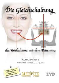 Die Gleichschaltung des Artikulators mit dem Patienten
