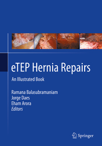 eTEP Hernia Repairs