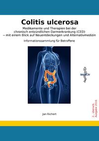 Colitis ulcerosa - Medikamente und Therapien bei der chronisch entzündlichen Darmerkrankung (CED) - mit einem Blick auf Neuentdeckungen und Alternativmedizin