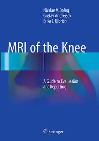 MRI of the Knee