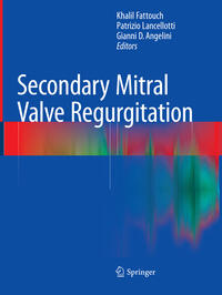 Secondary Mitral Valve Regurgitation