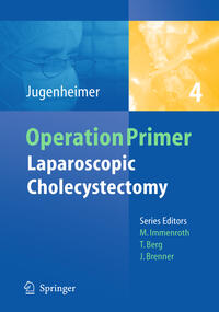 Vorderes Coverbild Laparoscopic Cholecystectomy