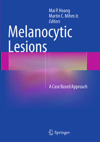 Melanocytic Lesions