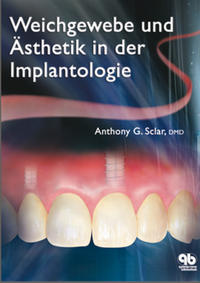 Weichegewebe und Ästhetik in der Implantologie