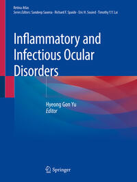 Inflammatory and Infectious Ocular Disorders