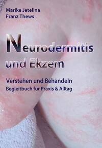 Neurodermitis und Ekzem