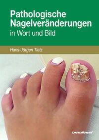 Pathologische Nagelveränderungen in Wort und Bild