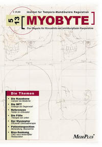 MYOBYTE 5-13