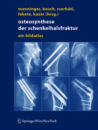 Vorderes Coverbild Osteosynthese der Schenkelhalsfraktur