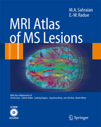 MRI Atlas of MS Lesions