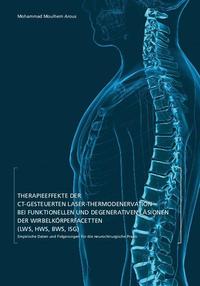 Therapieeffekte der CT-gesteuerten Laser-Thermodenervation bei funktionellen und degenerativen Läsionen der Wirbelsäulenfacetten (LWS, HWS, BWS, ISG)