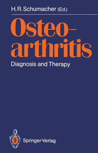 Vorderes Coverbild Osteoarthritis